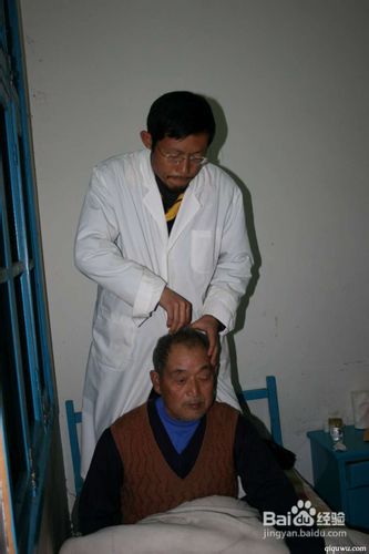 治疗头痛的十个特效穴