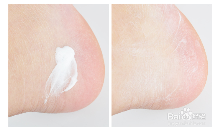 PROFOOT护足霜的使用方法