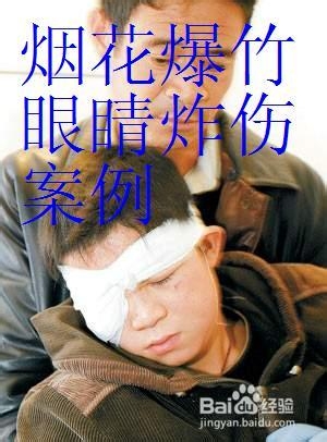 烟花爆竹燃放实用技巧(安全事项、突发情况处理)