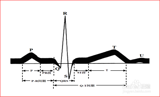 心电图各种波段解析