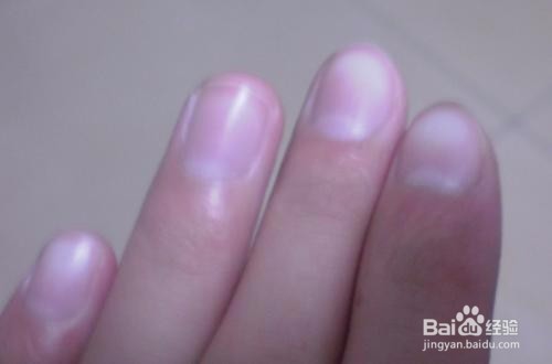 手指甲有点泛白是什么原因