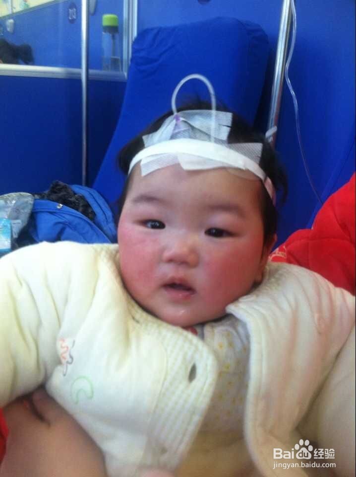 怎样处理宝宝的感冒问题