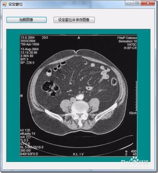 LeadTools在图像中设定窗位的具体方法