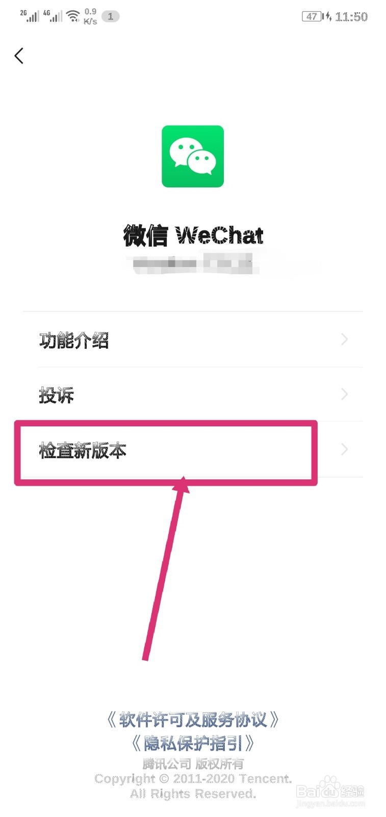 iwatch微信听不了语音怎么办