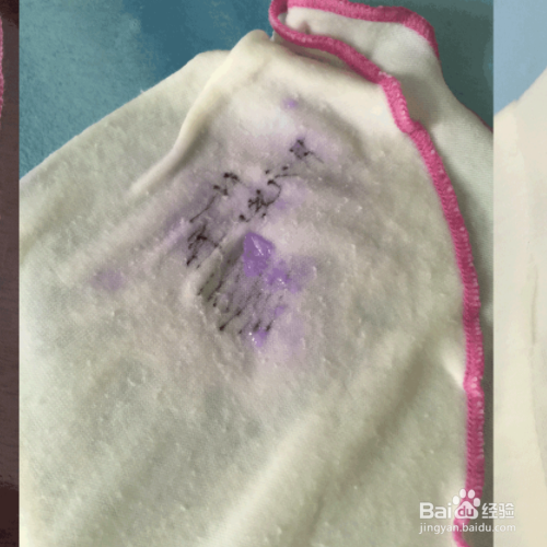 圆珠笔印怎么去除圆珠笔印怎么去除