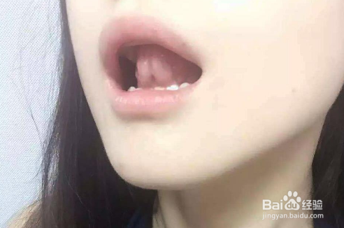 女生怎么瘦双下巴的有效方法