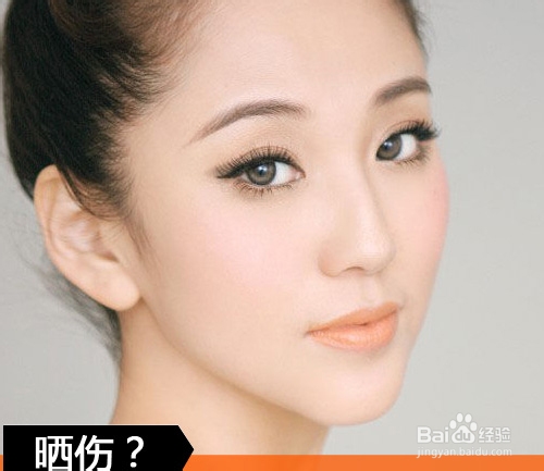 紫外线在作怪 做好防晒告别小雀斑