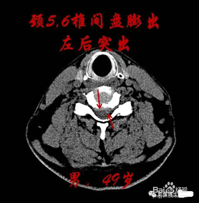 乳胶枕的好处 作用