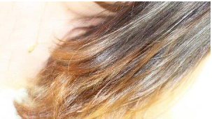 怎样根据头部判断身体所需补充的营养