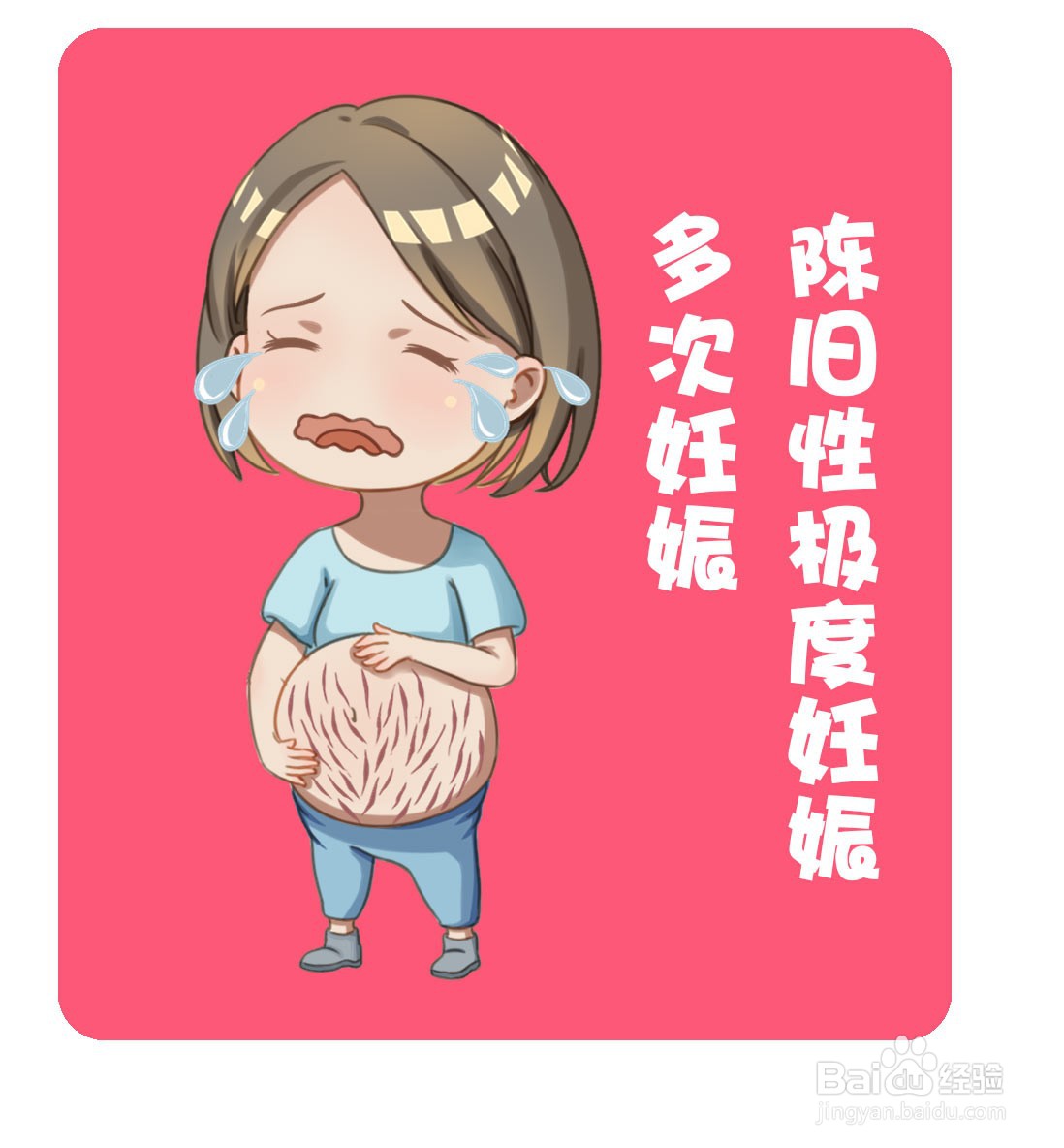 如何治疗妊娠纹