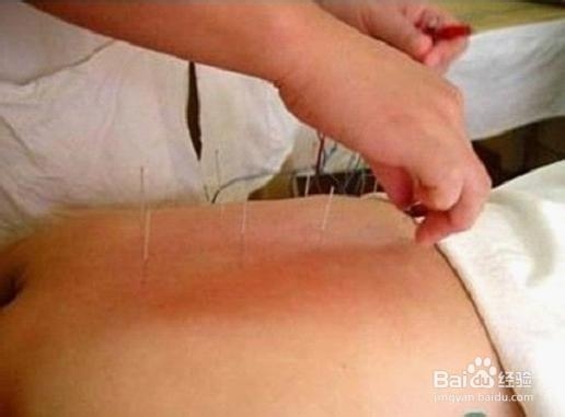 最新阐述国贸针灸减肥养生减肥的原理