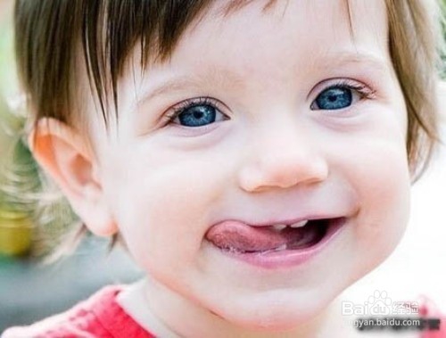 牙结石怎样有效预防?