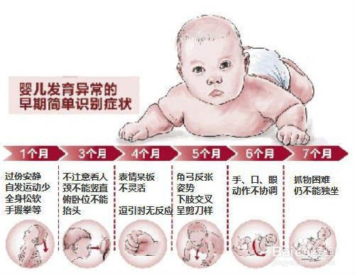 八种异常姿势来快速判断宝宝是否有脑瘫