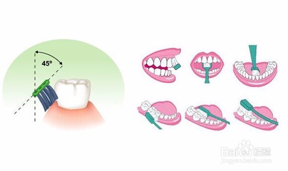 这些对待牙齿的习惯是错的你知道吗