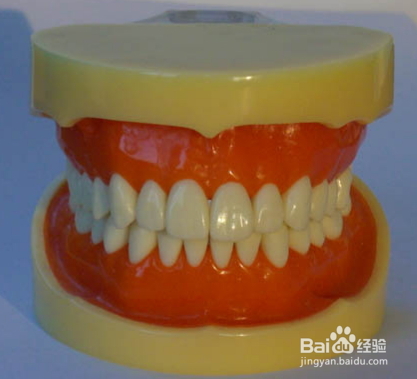 牙齿矫正(成人)方法
