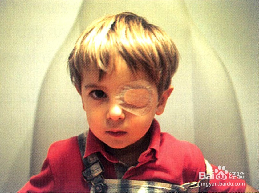 家长在孩子弱视治疗中应注意什么？