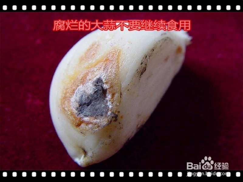 大蒜怎么吃才对身体有利,哪几类人群不能吃?