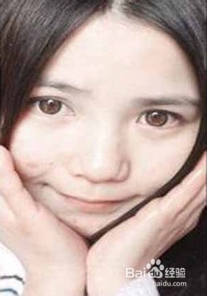 教你如何快速祛痘的有效方法