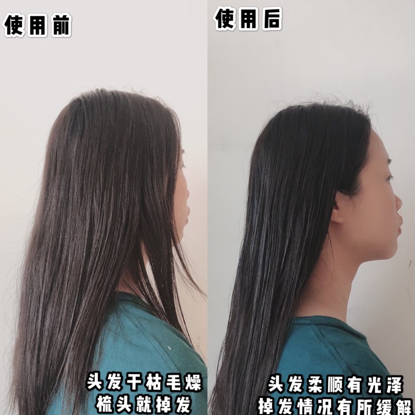 秃头少女终于有救了!!