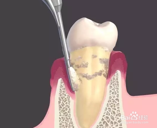 花钱洗一次牙,到底值不值?