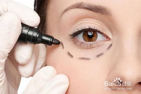 怎么样减轻眼袋