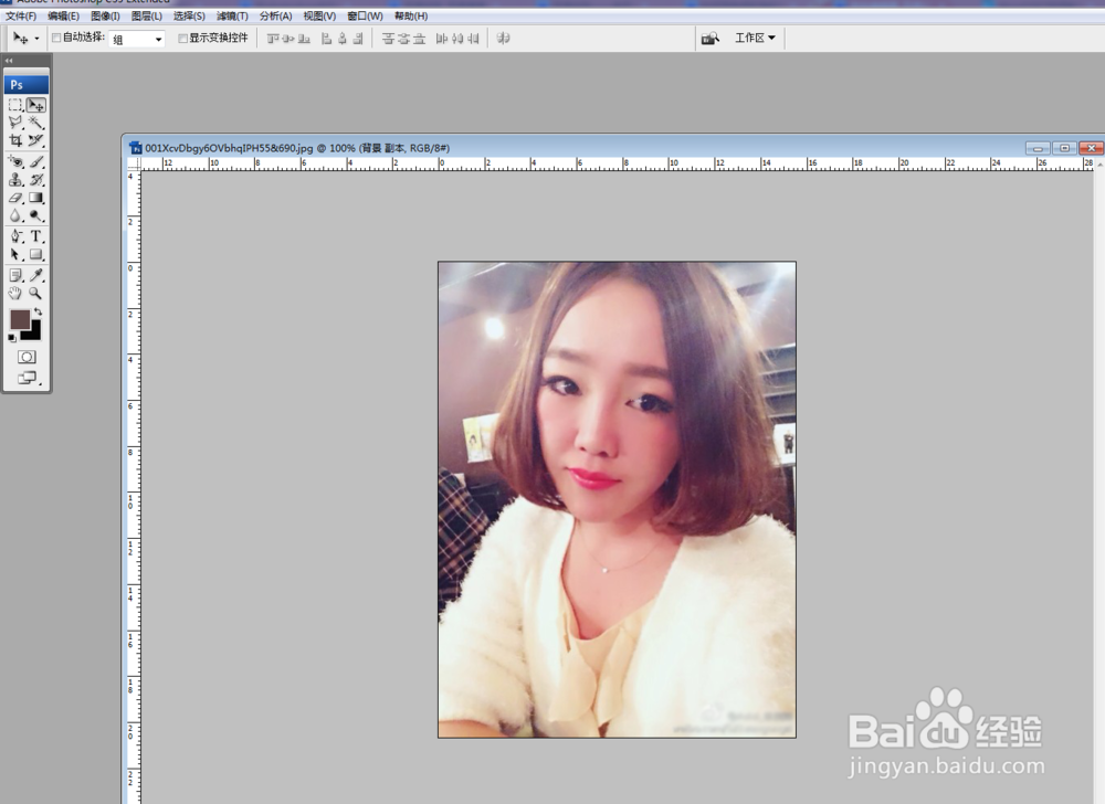 如何去除脸上的痦子?