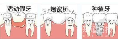 门牙磕掉了怎么办最真实的经验分享