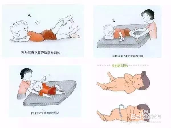 脑瘫康复训练图文版，从抬头训练到行走训练教程