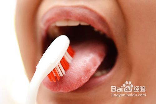 如何获得完美的牙齿