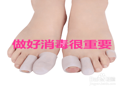 新鞋子很磨脚怎么办？