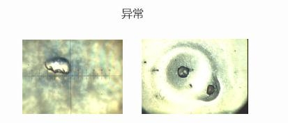 早期TAP肿瘤检测流程