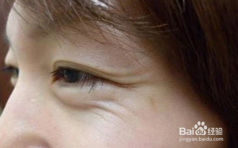 女生抽烟的危害有哪些?