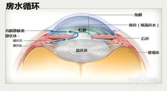 6个表现需要警惕青光眼