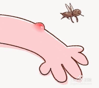 红霉素软膏的妙用