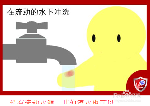 被狗狗咬伤以后要怎么办