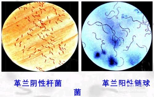 革兰氏染色步骤 百度经验