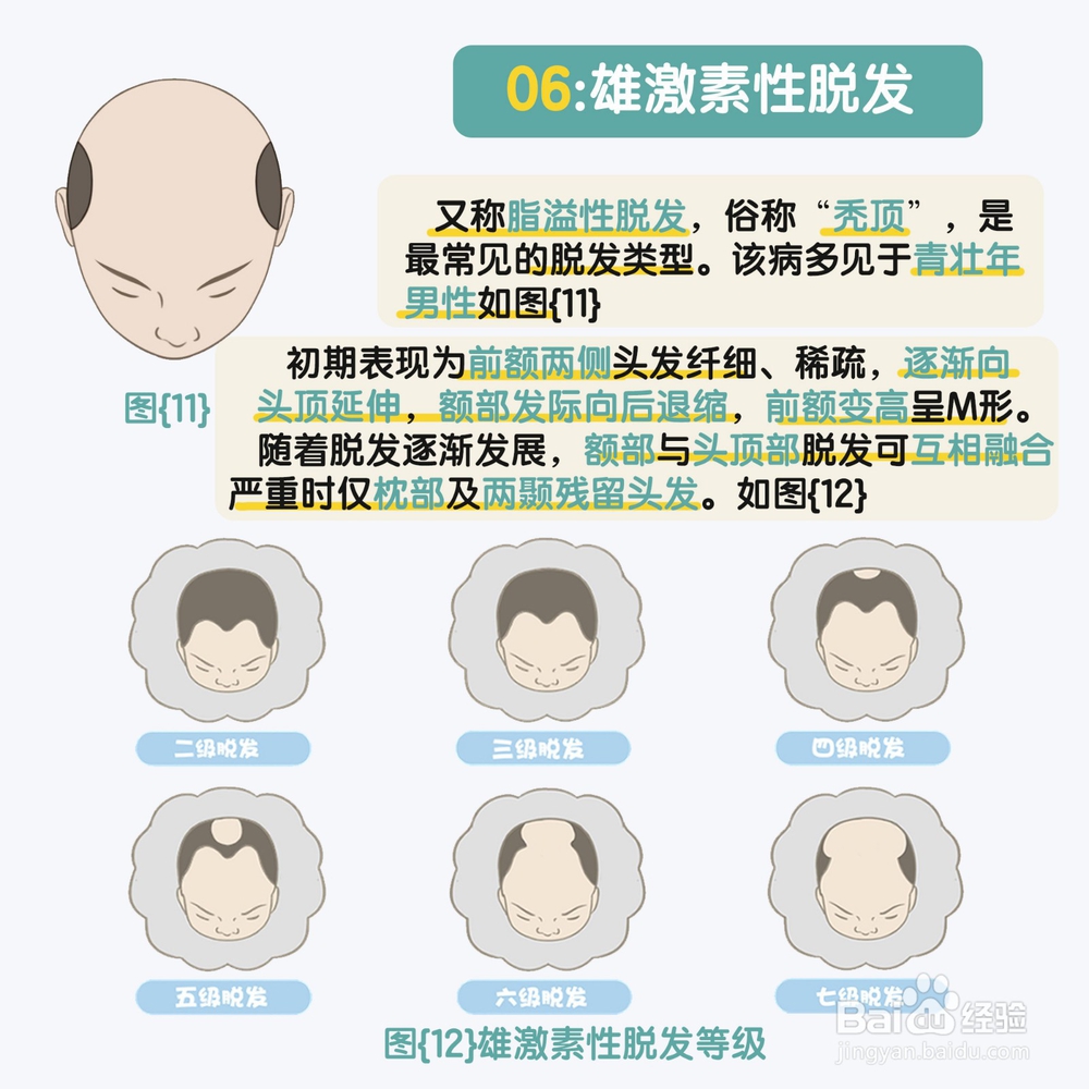 造成脱发的原因