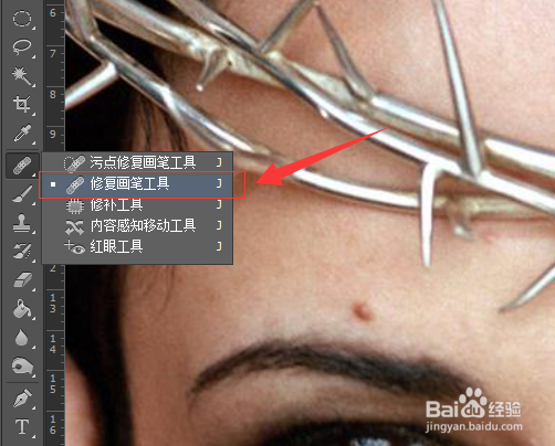 怎么简单地用PS祛斑祛痘