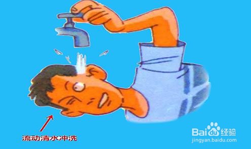 洗衣液进眼睛了怎么办