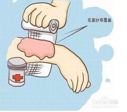 烫伤我们该如何处理?