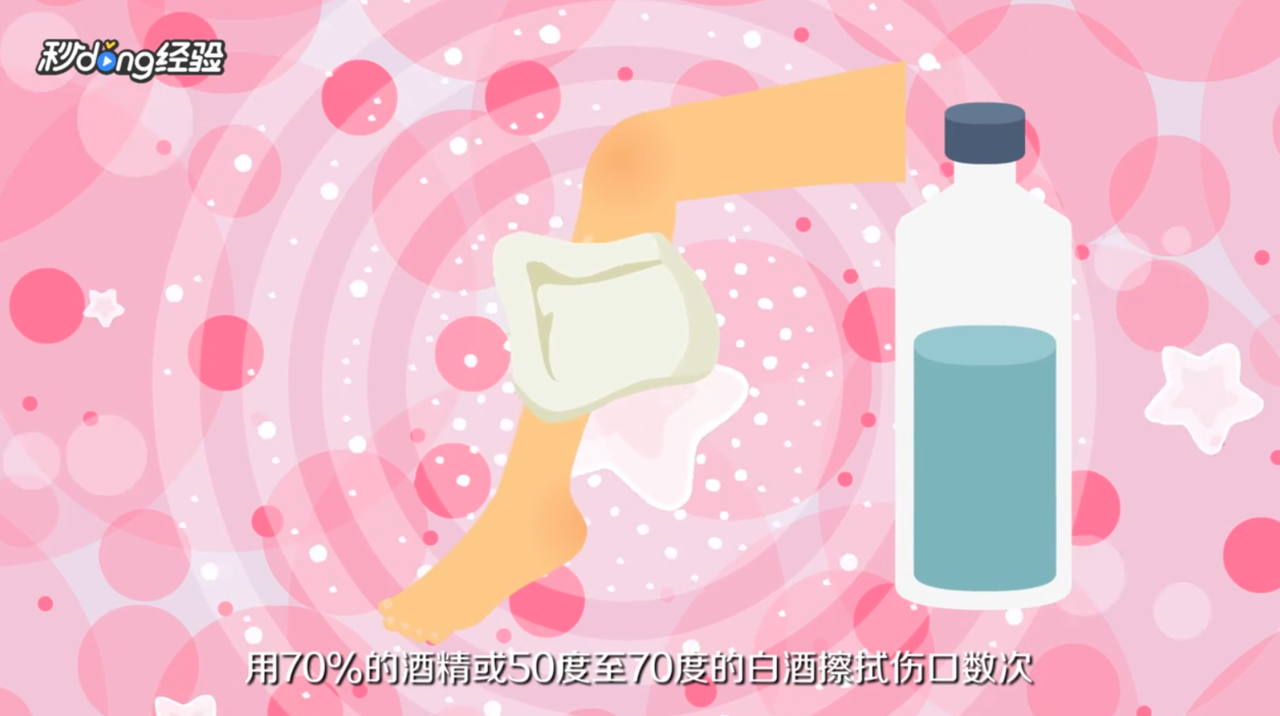 被狗咬了怎么处理伤口