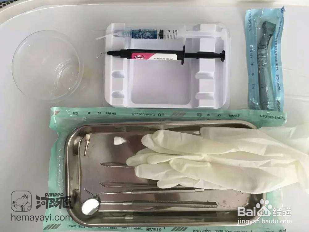 什么是窝沟封闭,为什么要做窝沟封闭?