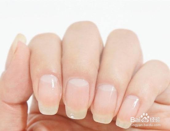 若有这4个“信号”，说明肝脏不太好