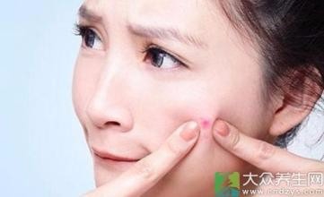 这8种肌肤问题概括了99%的人,你中了几枪?