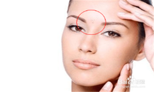 脸上长痘痘都有哪些原因？