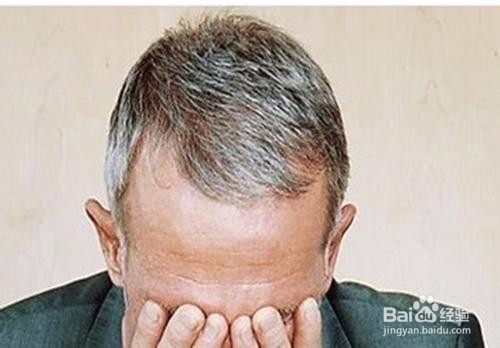 头发真的可以种植吗？