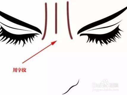 后脑勺有川字纹得怎么去除