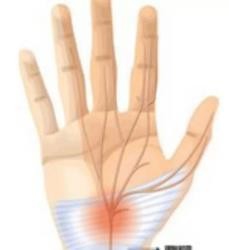 经常感觉手麻，怎么办？