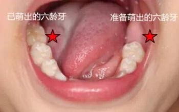 孩子换牙家长必须知道的事情