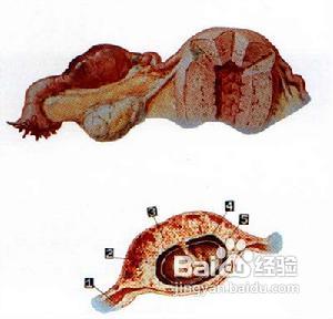 孕早期应及时检查确认